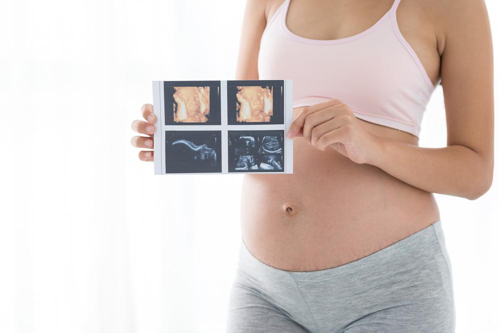Trudnoća: Zašto na 3D ultrazvuk