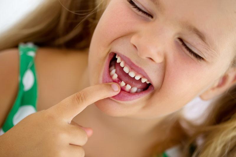 Zdravo dijete: Obavezno liječite mliječne zube
