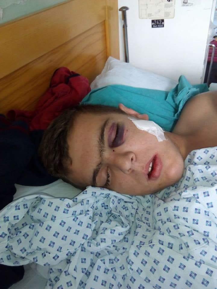 Dječak u Tešnju brutalno pretučen - Avaz
