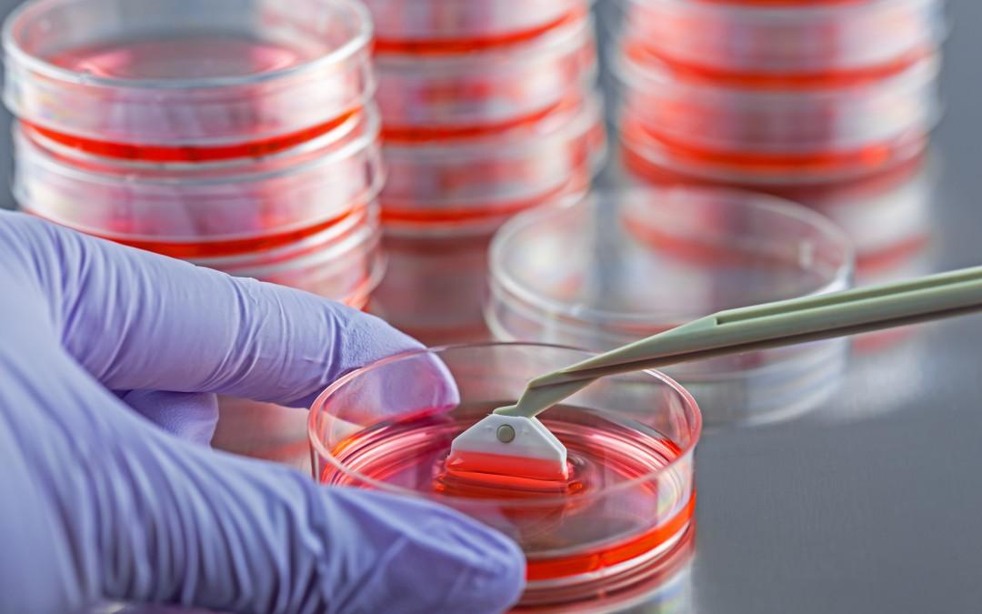 12 Amerikanaca se zarazilo bakterijom kroz matične ćelije