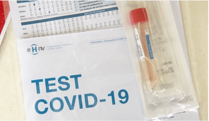 Američka agencija za lijekove odobrila prvi kućni test za koronavirus