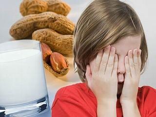 Osam najčešćih krivaca za alergije na hranu kod djece