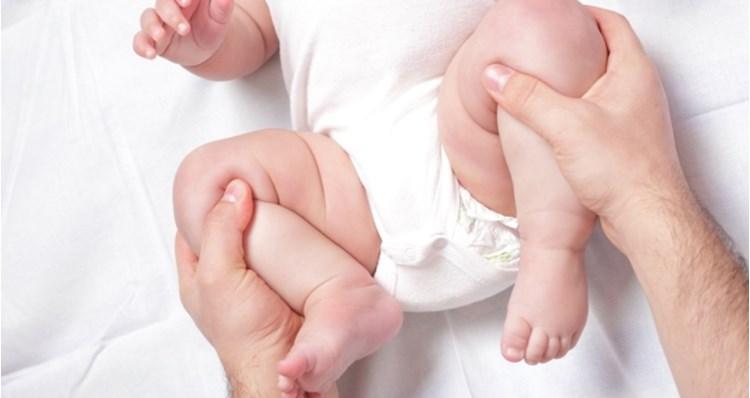 Potpuno iščašenje javlja se kod 1,5 na 1.000 novorođenčadi - Avaz