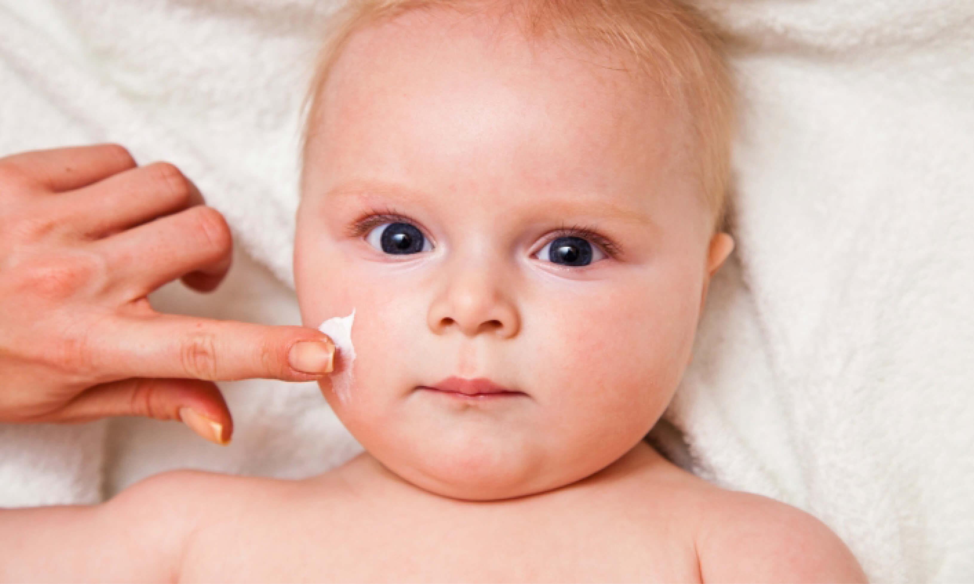 Ekcem kod beba - zašto nastaje i kako se liječi
