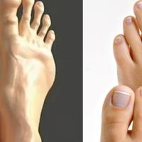 Evo kako će ljudska stopala izgledati za 100 godina