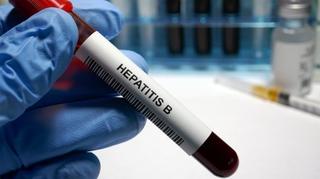Raste broj oboljelih od hepatitisa B 