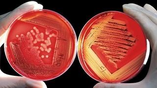 Pronađen jedinstven antibiotik na koji bakterije nemaju odgovor