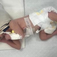 Beba trudnice koja je ubijena u izraelskom napadu pod medicinskom njegom
