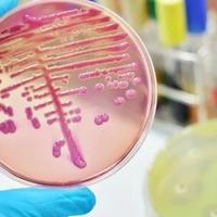 Razvijen novi način uništavanja bakterija otpornih na antibiotike: Potrebna samo jedna doza