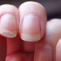 Evo načina da spriječite listanje noktiju 