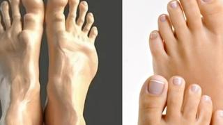 Evo kako će ljudska stopala izgledati za 100 godina