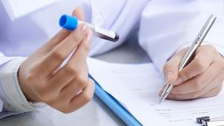 Novi krvni test otkriva koji će nam organ otkazati prvi